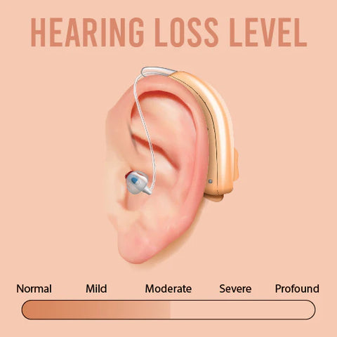 Buy Background Noise Reduction Otofonix ELITE Hearing Aid - DMG Medical Supply Buy Background Noise Reduction Otofonix ELITE Hearing Aid - DMG Medical Supply